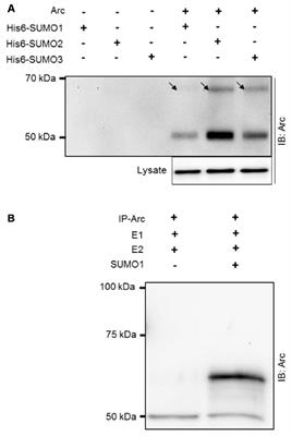 Dynamic Arc SUMOylation and Selective Interaction with F-Actin-Binding Protein Drebrin A in LTP Consolidation In Vivo